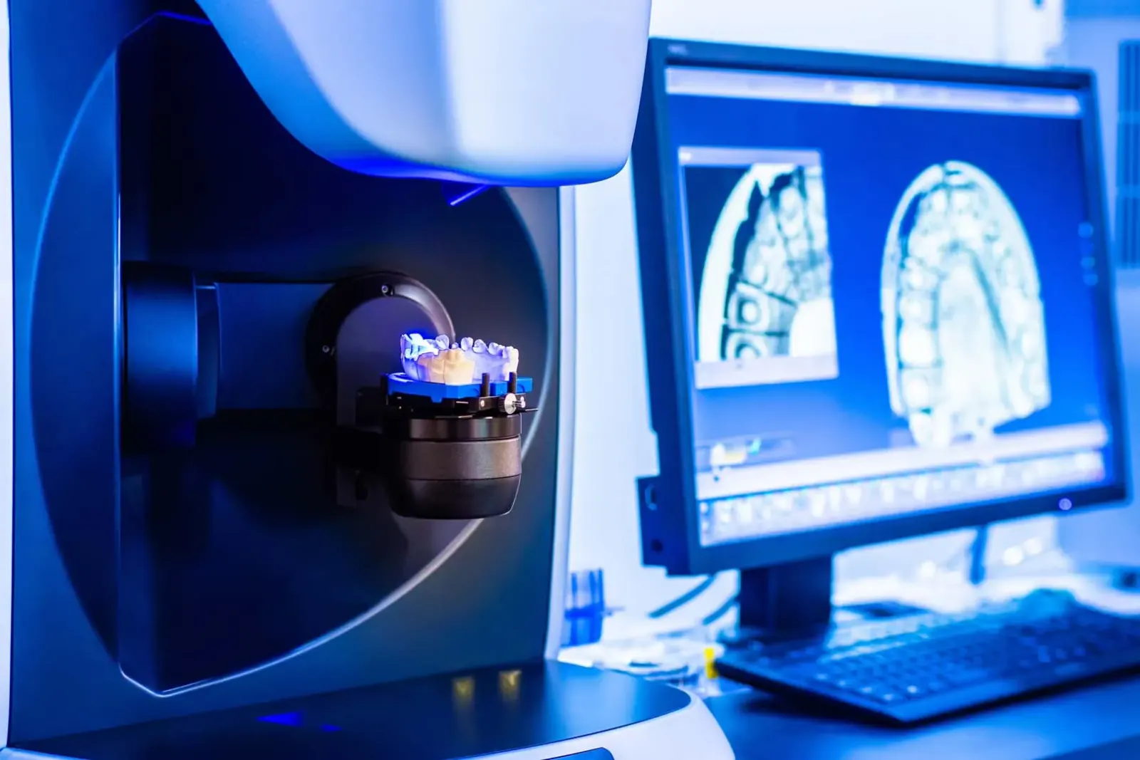 Precision-Fit Digital Dentures in Newkirk, OK